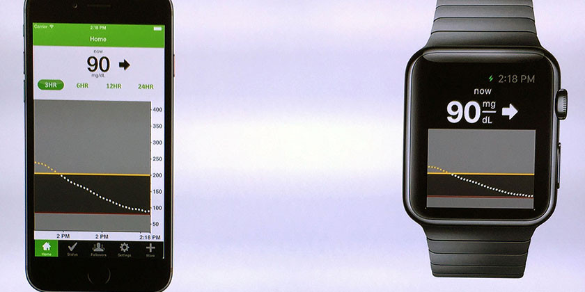 Apple Watch Dexcom